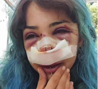 Studentessa picchiata a Bari, due adulti identificati per il pestaggio