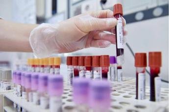 Dal microbiota una speranza contro l’epilessia resistente, lo studio italiano